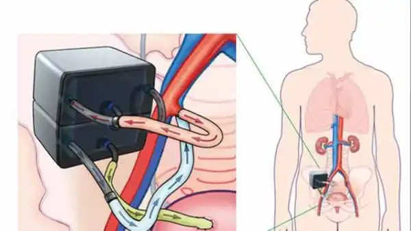 Scientists get closer to developing bioartificial kidney